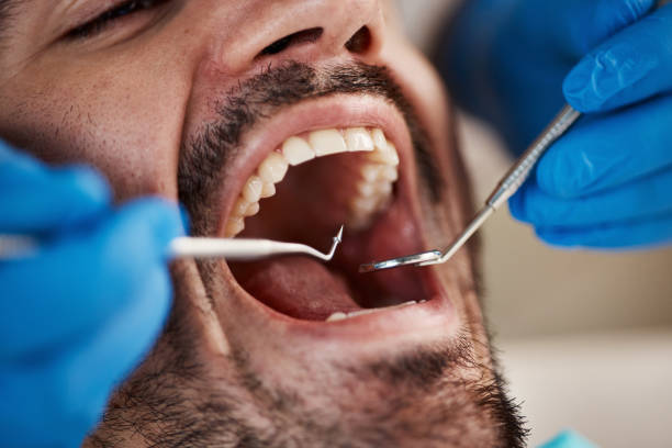 Emergency Dental Services in Welcome, NC